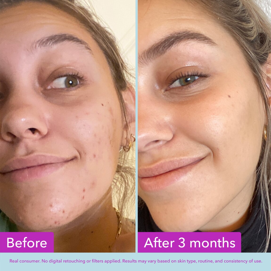 niacinamide-brightening-toner-h0 zb_p.jpg