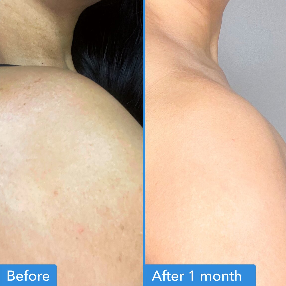 discoloration-correcting-body-treatment-e7 zb_p.jpg