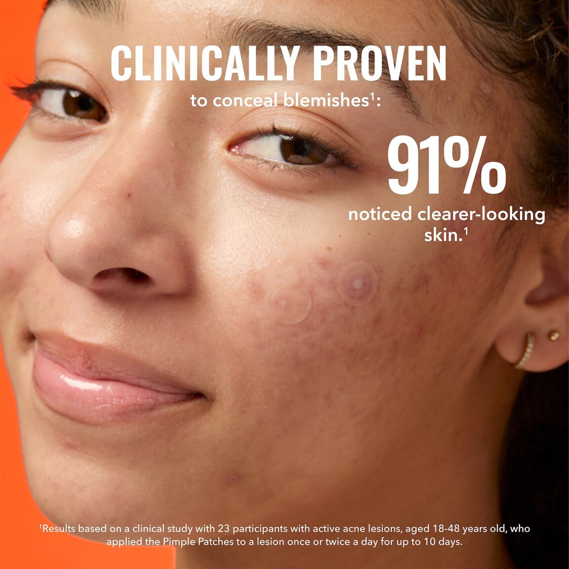pimple-patches-r4 zb_p.jpg